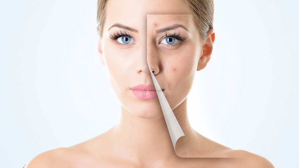 Акнето и почистване на лице от козметик